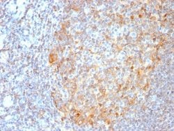 MALT1 Antibody (MT1/3159R) - Azide and BSA Free, Novus Biologicals 100 &mu;g | Buy Online | Novus Biologicals | Fisher Scientific